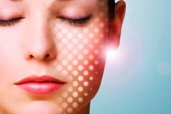 non-ablative skin rejuvenation laser