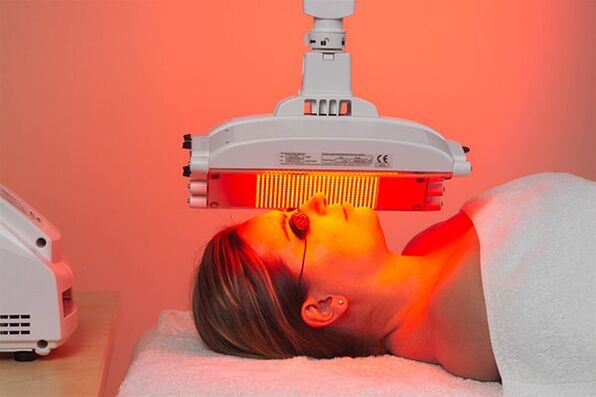 Light therapy hardware method to prevent the first signs of aging